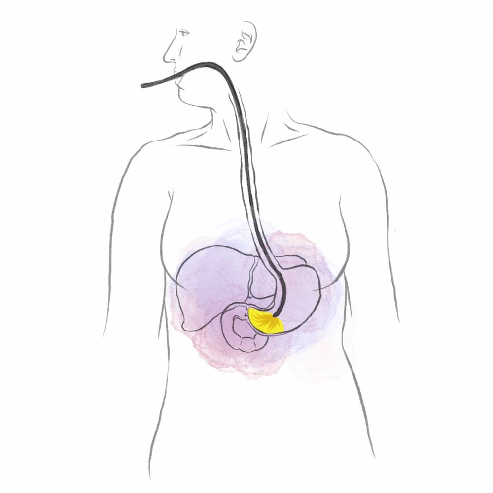 Endoscopy Adelaide Dr Balalis Upper GI & Bariatric Surgeon